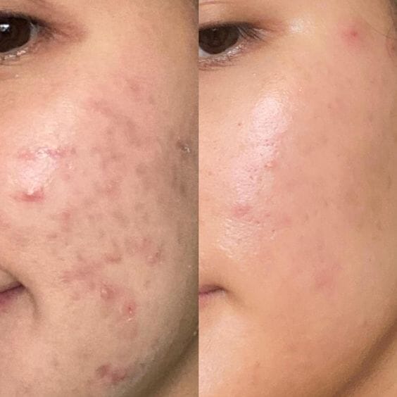 Vegan Hydratation Mask Masque Hydratant Beauty Cut By Fred